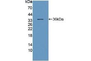 Detection of Recombinant DNAH11, Human using Polyclonal Antibody to Dynein, Axonemal, Heavy Chain 11 (DNAH11) (DNAH11 anticorps  (AA 17-299))