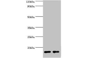 Western blot All lanes: Gastrotropin antibody at 8 μg/mL Lane 1: Mouse small intestine tissue Lane 2: Rat small intestine tissue Secondary Goat polyclonal to rabbit IgG at 1/10000 dilution Predicted band size: 15, 20 kDa Observed band size: 15 kDa (FABP6 anticorps  (AA 1-128))