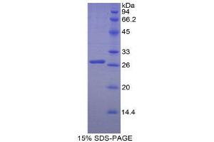 SDS-PAGE (SDS) image for Transferrin Receptor (p90, CD71) (TFRC) (AA 585-771) protein (His tag) (ABIN2123864)