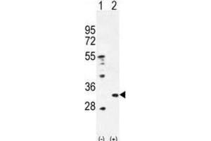 Western Blotting (WB) image for anti-Peroxiredoxin 4 (PRDX4) antibody (ABIN2996535) (Peroxiredoxin 4 anticorps)