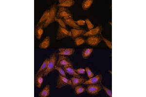 Immunofluorescence analysis of U-2 OS cells using RPL27 Polyclonal Antibody (ABIN6133040, ABIN6147127, ABIN6147128 and ABIN6216885) at dilution of 1:100 (40x lens).