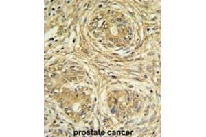 Immunohistochemistry (IHC) image for anti-Suppressor of Var1, 3-Like 1 (SUPV3L1) antibody (ABIN3004313)