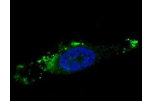 Fluorescent image of chloroquine-treated U251 cells stained with ATG12 antibody.