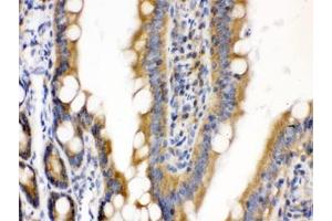 IHC testing of FFPE rat intestine with CDCP1 antibody. (CDCP1 anticorps)