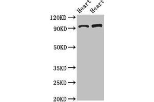 Western Blot Positive WB detected in: Rat heart tissue, Mouse heart tissue All lanes: GPAM antibody at 3. (GPAM anticorps  (AA 281-459))