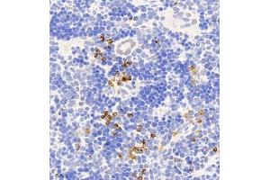 Immunohistochemistry of paraffin embedded rat spleen using CD177 (ABIN7073372) at dilution of 1:1000 (400x lens)