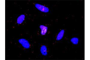 Proximity Ligation Analysis of protein-protein interactions between EGFR and CTNNA1. (EGFR anticorps  (AA 1-405))