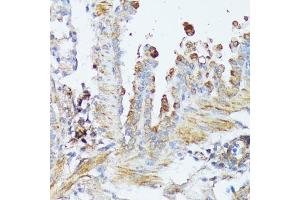 Immunohistochemistry of paraffin-embedded mouse lung using WNT1 antibody (ABIN1683291, ABIN3016105, ABIN3016107 and ABIN6219551) at dilution of 1:100 (40x lens).
