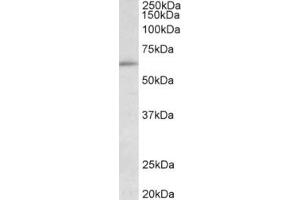 Western Blotting (WB) image for anti-Hypermethylated in Cancer 2 (HIC2) (Internal Region) antibody (ABIN2465146) (HIC2 anticorps  (Internal Region))