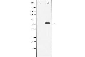 Western blot analysis of RUNX2 expression in HeLa cells,The lane on the left is treated with the antigen-specific peptide. (RUNX2 anticorps  (Internal Region))