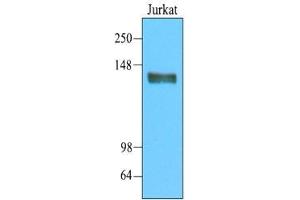 Cell lysates of Jurkat(20 ug) were resolved by SDS-PAGE, transferred to nitrocellulose membrane and probed with anti-human CD45 (1:2000). (CD45 anticorps  (AA 1029-1249))