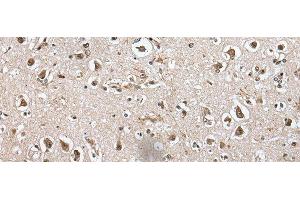 Immunohistochemistry of paraffin-embedded Human brain tissue using METAP1D Polyclonal Antibody at dilution of 1:60(x200) (MAP1D anticorps)