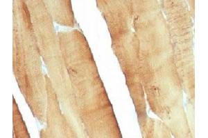 Formalin-fixed, paraffin-embedded rat skeletal muscle stained with pan Muscle Actin antibody