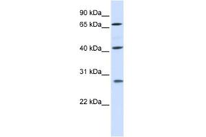 WB Suggested Anti-RDM1 Antibody Titration: 0. (RDM1 anticorps  (Middle Region))