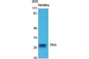 Western Blot (WB) analysis of specific cells using PSCA Polyclonal Antibody. (PSCA anticorps  (Internal Region))
