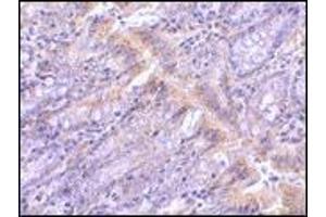 AP20061PU-N PIST antibody staining of Rat Colon tissue by Immunohistochemistry at 1 μg/ml. (GOPC anticorps  (Middle Region))