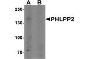 Western blot analysis of PHLPP2 in SW480 cell lysate with PHLPP2 Antibody  at 1 μg/ml in (A) the presence and (B) the absence of blocking peptide.