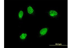 Immunofluorescence of monoclonal antibody to MAPK6 on HeLa cell.