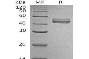 Western Blotting (WB) image for Interleukin 23 (IL23) protein (ABIN7320590) (IL23 Protéine)