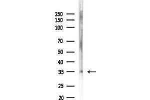anti-Melanoma Antigen Family A, 12 (MAGEA12) (Internal Region) antibody