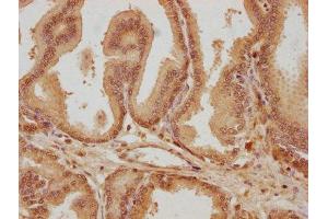 IHC image of ABIN7145007 diluted at 1:300 and staining in paraffin-embedded human prostate tissue performed on a Leica BondTM system.