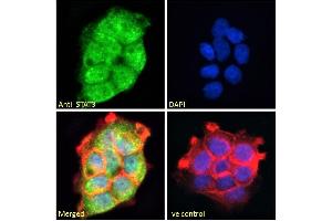 ABIN184593 Immunofluorescence analysis of paraformaldehyde fixed A431 cells, permeabilized with 0.