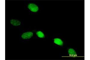 Immunofluorescence of purified MaxPab antibody to SOX13 on HeLa cell. (SOX13 anticorps  (AA 1-622))