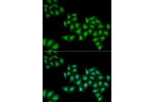 anti-DEAD (Asp-Glu-Ala-Asp) Box Polypeptide 1 (DDX1) (AA 441-740) antibody