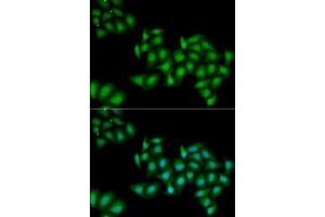 Immunofluorescence analysis of MCF7 cells using DDX1 antibody. (DDX1 anticorps  (AA 441-740))