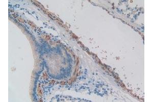 Detection of EDN1 in Mouse Lung Tissue using Polyclonal Antibody to Endothelin 1 (EDN1)