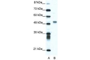 WB Suggested Anti-FLI1  Antibody Titration: 1. (FLI1 anticorps  (N-Term))