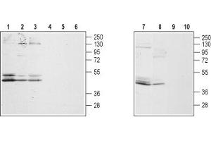 Western blot analysis of rat hippocampus, DRG (lanes 2 and 5), brain (lanes 3 and 6), mouse brain (lanes 7 and 9) and human prostate carcinoma LNCaP cell lysates: - 1,2,3,7,8. (GALR2 anticorps  (3rd Intracellular Loop))