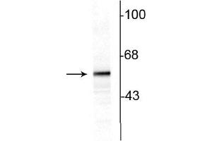 Western blot of 10ug of rat striatal lysate showing specific immunolabeling of the ~60 kDa tyrosine hydroxylase protein. (Tyrosine Hydroxylase anticorps)