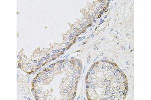 Immunohistochemistry of paraffin-embedded Human prostate using CIB1 Polyclonal Antibody at dilution of 1:100 (40x lens). (CIB1 anticorps)