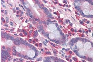 Human Small Intestine: Formalin-Fixed, Paraffin-Embedded (FFPE) (DPF2 anticorps  (AA 56-155))