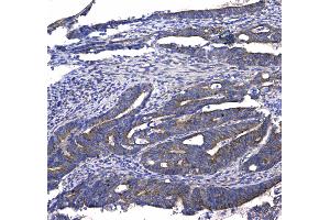 IHC analysis of GSTM3 using anti-GSTM3 antibody .