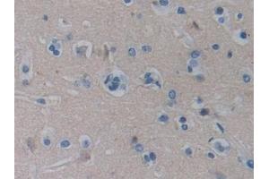 Detection of BGN in Human Cerebrum Tissue using Polyclonal Antibody to Biglycan (BGN)