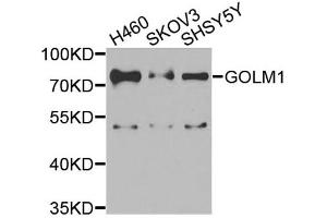 Western blot analysis of extracts of various cell lines, using GOLM1 antibody (ABIN5974385) at 1/1000 dilution. (GOLM1 anticorps)