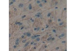 IHC-P analysis of brain tissue, with DAB staining. (TRPM7 anticorps  (AA 19-179))