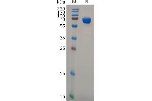 Human Protein, hFc Tag on SDS-PAGE under reducing condition.