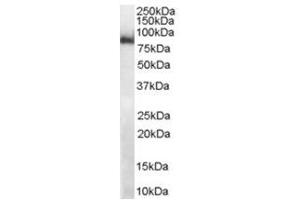 Image no. 2 for anti-Midline 2 (MID2) (C-Term) antibody (ABIN374299) (Midline 2 anticorps  (C-Term))