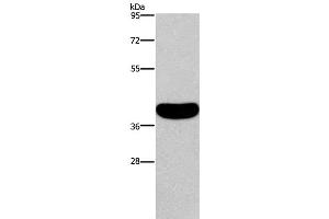 Western Blot analysis of Human normal colon tissue using CRELD2 Polyclonal Antibody at dilution of 1:550 (CRELD2 anticorps)