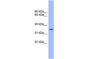 WB Suggested Anti-OR2C3 Antibody Titration: 1. (OR2C3 anticorps  (C-Term))