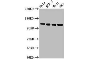 Western Blot Positive WB detected in: Hela whole cell lysate, MCF-7 whole cell lysate, Raji whole cell lysate, 293 whole cell lysate All lanes: MCM2 antibody at 4. (MCM2 anticorps  (AA 2-904))
