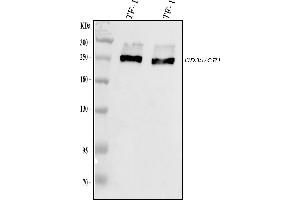 Western blot analysis of CD35 using anti-CD35 antibody (ABIN7599703).