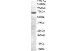 Image no. 1 for anti-PR Domain Containing 4 (PRDM4) (C-Term) antibody (ABIN374481) (PRDM4 anticorps  (C-Term))