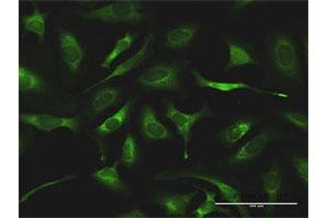 Immunofluorescence of purified MaxPab antibody to QARS on HeLa cell.