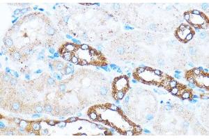 Immunohistochemistry of paraffin-embedded Mouse kidney using PIK3CA Polyclonal Antibody at dilution of 1:100 (40x lens). (PIK3CA anticorps)