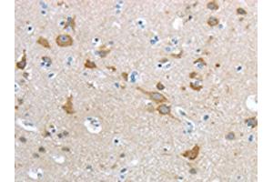 The image on the left is immunohistochemistry of paraffin-embedded Human brain tissue using ABIN7190915(HCN4 Antibody) at dilution 1/20, on the right is treated with synthetic peptide. (HCN4 anticorps)