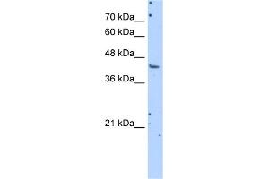 WB Suggested Anti-GOT1 Antibody Titration:  1. (GOT1 anticorps  (N-Term))